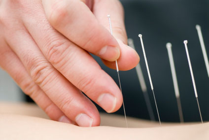 Acupuncture needles